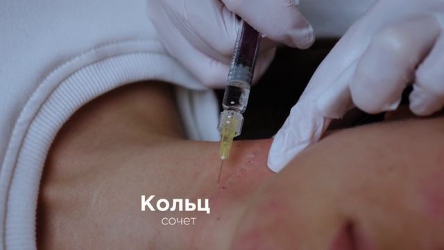 Bellarti Lift Техника биоактивных точек тренер Кизуб С А смотреть онлайн