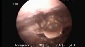 Голосовые связки