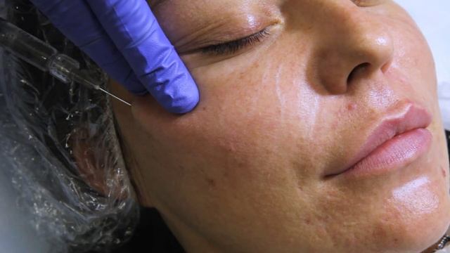 Софтфилинг смотреть онлайн