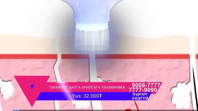 Трейд тв- Skinray batga xataagch смотреть онлайн