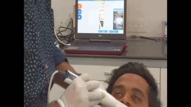 Launca Intraoral Scanner by Denstagenie смотреть онлайн