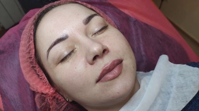Протокол Пилинг Dermagenetic TCA 20% смотреть онлайн