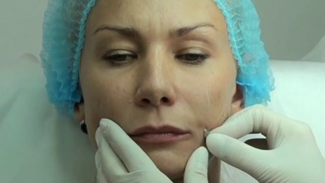 Работаем канюлей практический семинар