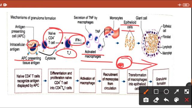 Type 4 Hypersensitivity Reactions | Made easy | Mechanism & Examples | Images смотреть онлайн