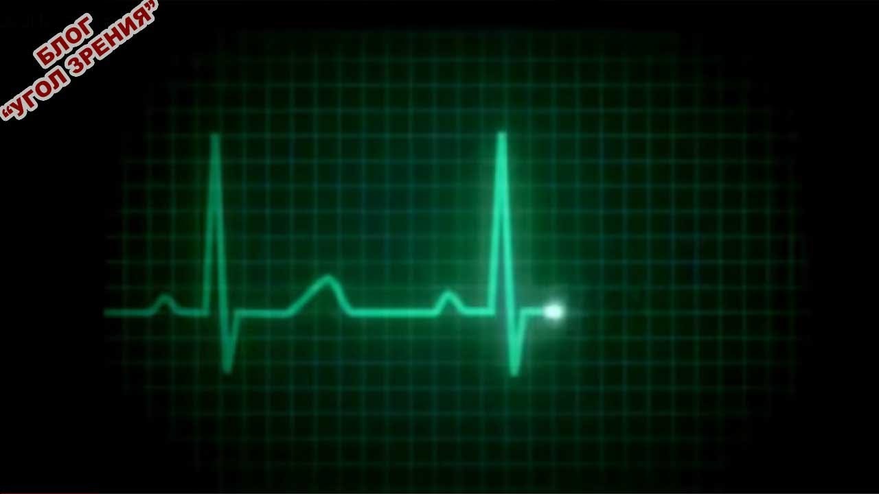 Линия жизни. смотреть онлайн