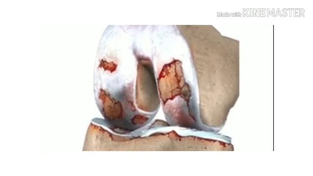 Vestige glucosamine tablet. जोड़ो के दर्द में फायदेमंद।। पूरी जानकारी смотреть онлайн