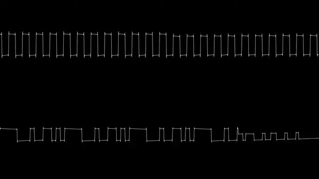Star Zone - Zippy the Porcupine (Atari 2600) [Oscilloscope] смотреть онлайн