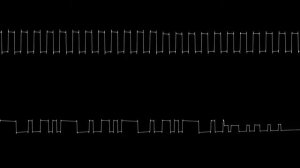 Star Zone - Zippy the Porcupine (Atari 2600) [Oscilloscope]