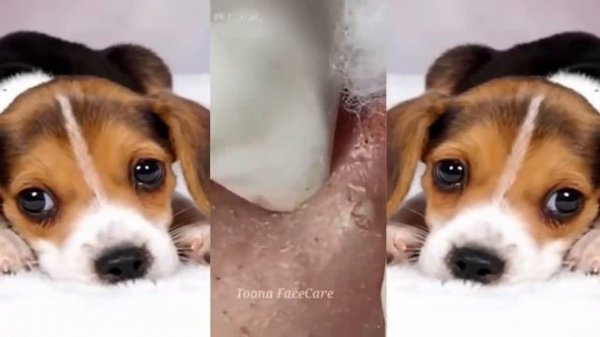 Relax squeezing out blackheads #63 Черные точки