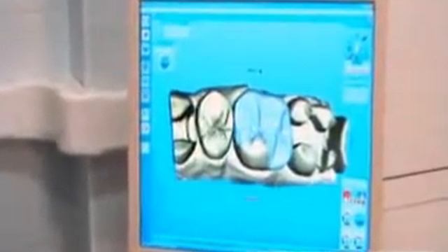 Керамическая реконструкция