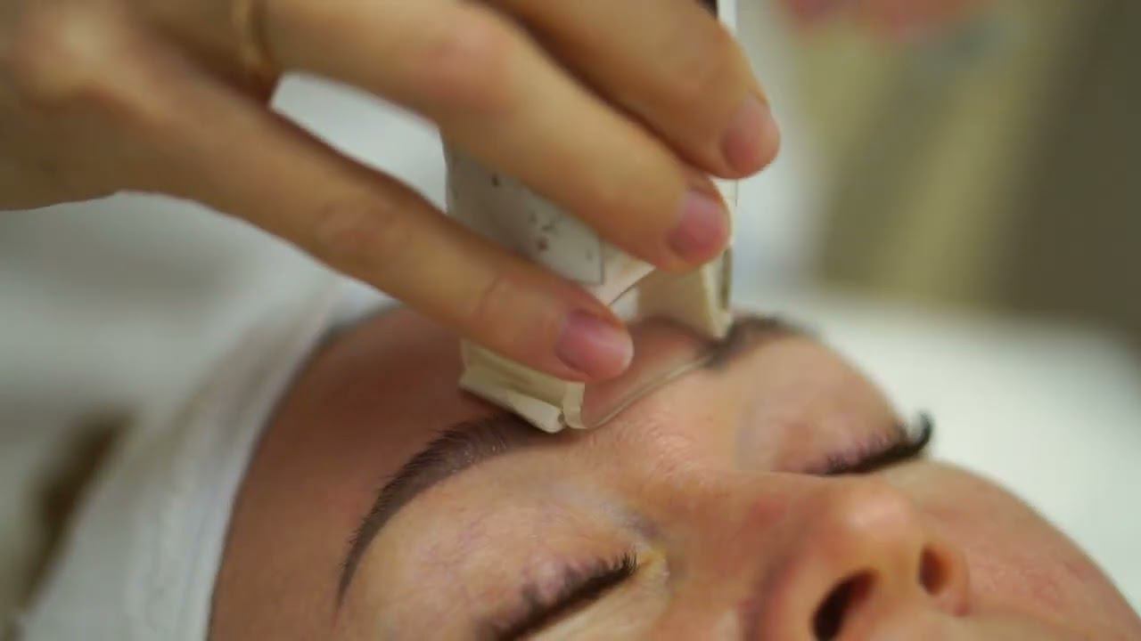 LPG-массаж лица Mobilift. смотреть онлайн