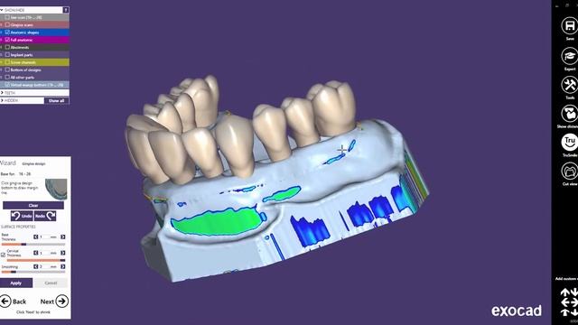exocad Видео урок передовые виртуальные десны и дизайн цифровой Waxup смотреть онлайн