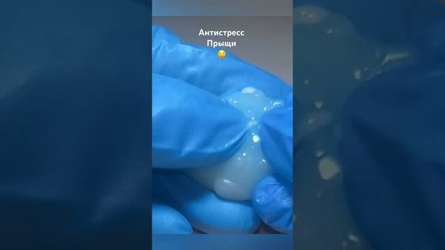 Антистресс. Прыщи. #казахстан #алматы#антистресс #прыщ #угри#игрушки #мягкаяигрушка смотреть онлайн