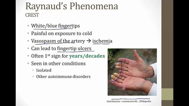 Scleroderma смотреть онлайн