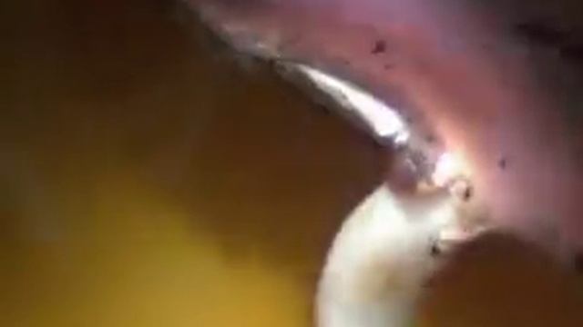 Прорастание семян фасоли смотреть онлайн