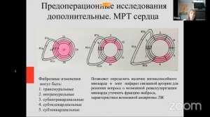 Особенности сердечной ресинхронизирующей терапии. Показания, критерии диагностики