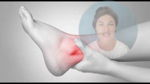 Ахиллово сухожилие.