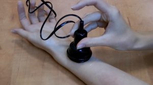 Фонофорез с гелем Ферменкол при помощи аппарата Ретон