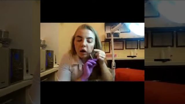 Процедура коррекции носогубных складок смотреть онлайн