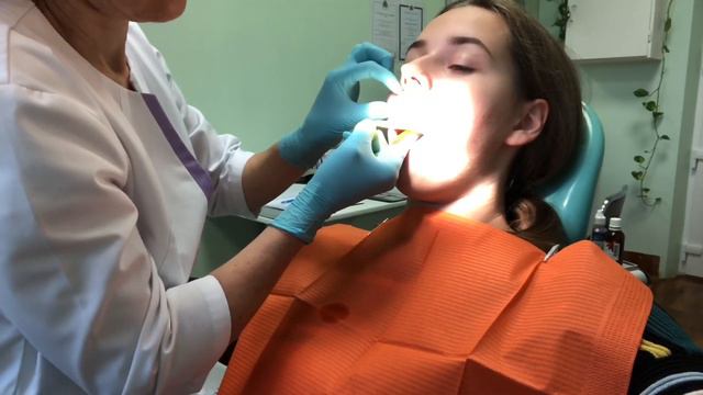 Брекеты часть 1 / Как мне делали слепки зубов? 🦷 смотреть онлайн