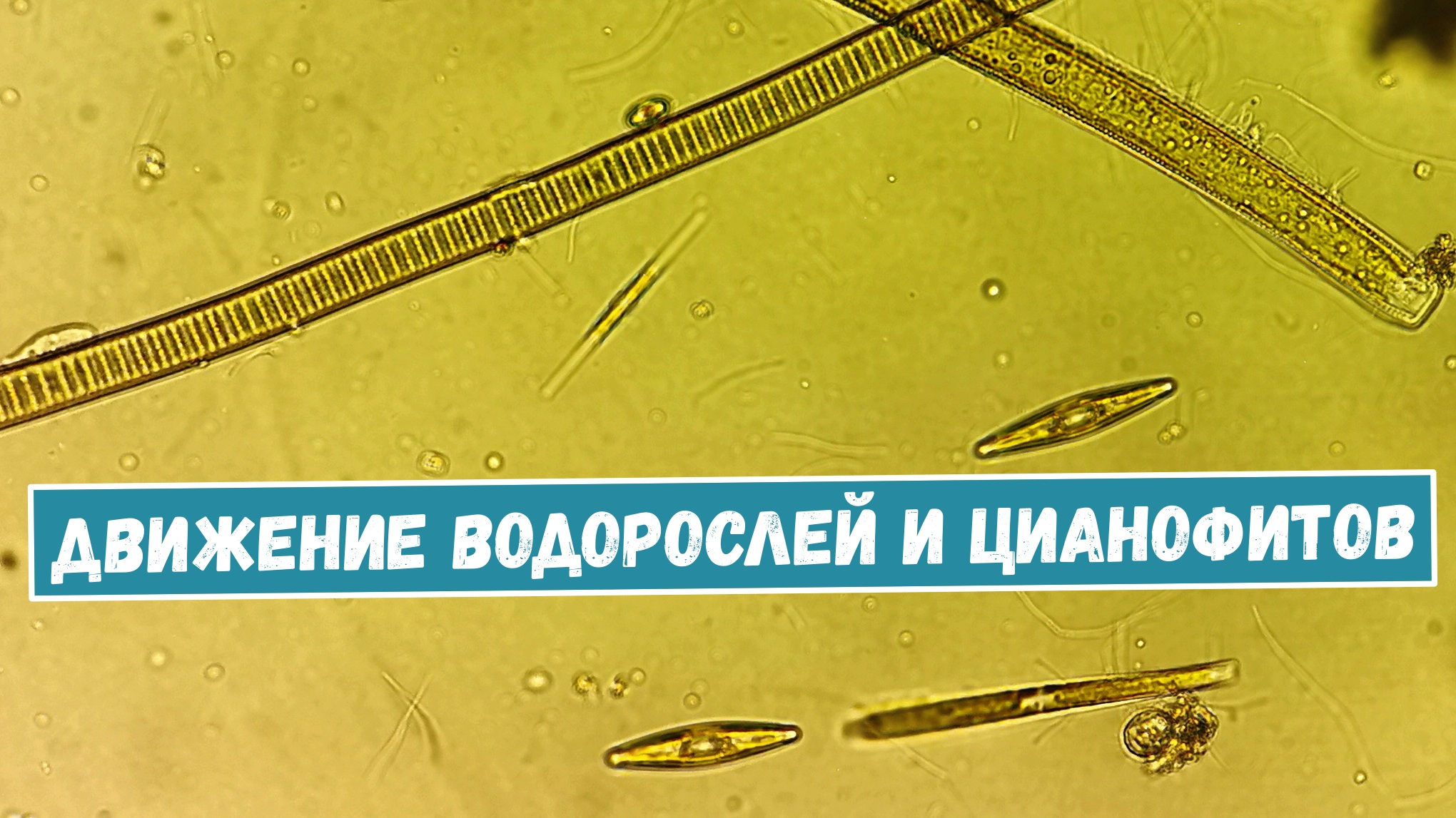 Что можно увидеть в капле воды из городского пруда? Часть 2 смотреть онлайн