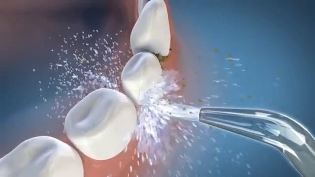 Waterpik Bico de Jato Clássico JT-100E - Extra Delivery смотреть онлайн