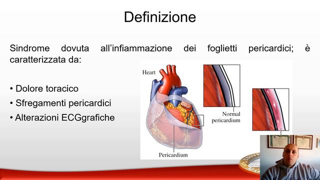 Patologia dell'endocardio e del pericardio - VECCHIO VIDEO AA 2019/2020 смотреть онлайн