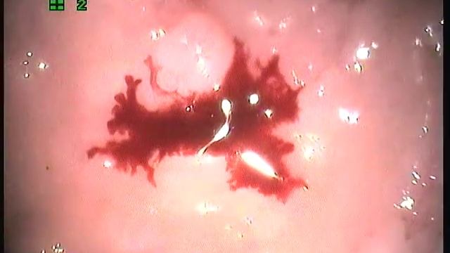 н\о желудка у кота смотреть онлайн