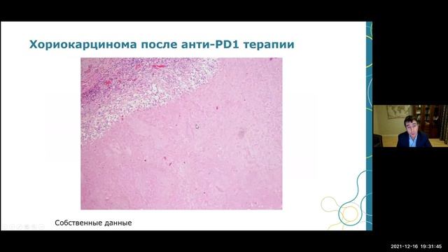 Морфологические особенности опухолей почки (Раскин Г.А.) смотреть онлайн