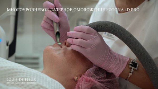 Многоуровневое лазерное омоложение Fotona 4D PRO в клинике Луи де Флер.