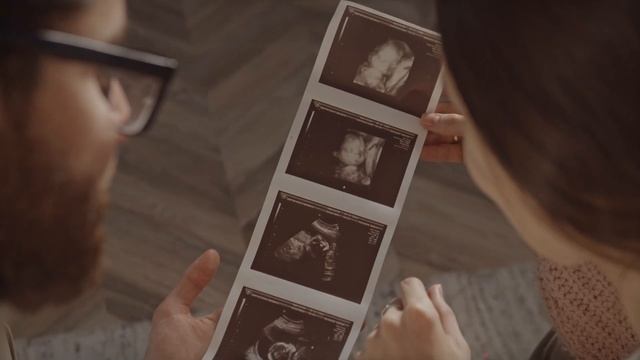 РОДЫ НЕ НАЧИНАЮТСЯ | Беременность 41 неделя а роды так и не наступают смотреть онлайн