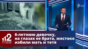 6-летнюю девочку, на глазах ее брата, жестоко избили мать и тетя