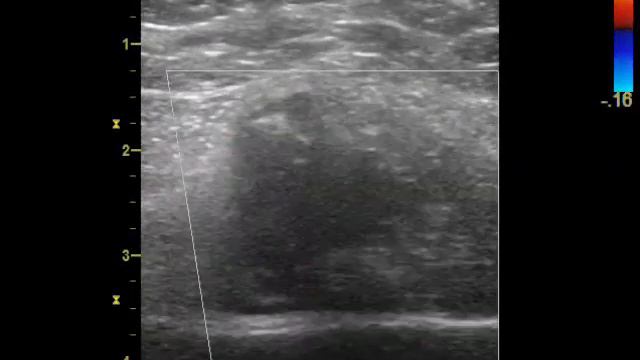 МТС в ребра. смотреть онлайн