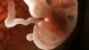 От зачатия — до рождения. Полная картина беременности