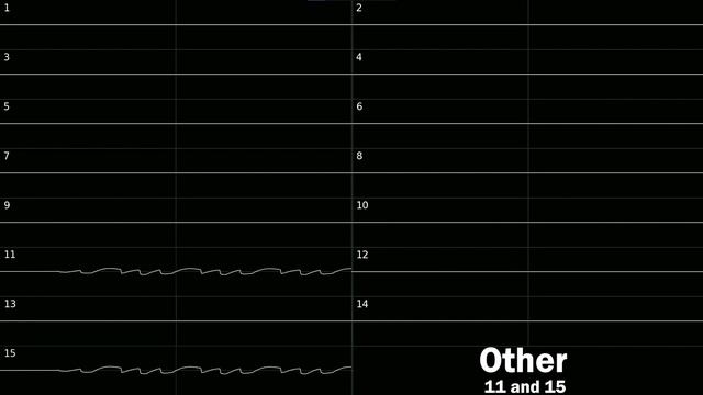 Rhythm Heaven (DS) - Remix 8 |Oscilloscope view| смотреть онлайн