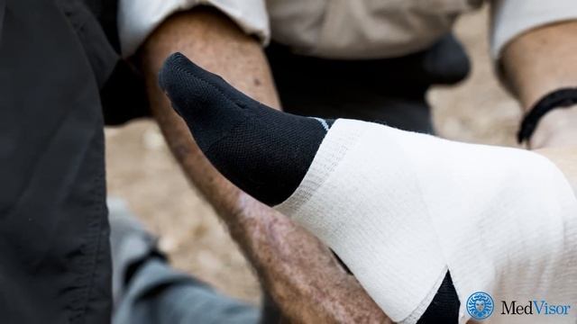 ЧТО ДЕЛАТЬ, ЕСЛИ ПОДВЕРНУЛ НОГУ смотреть онлайн