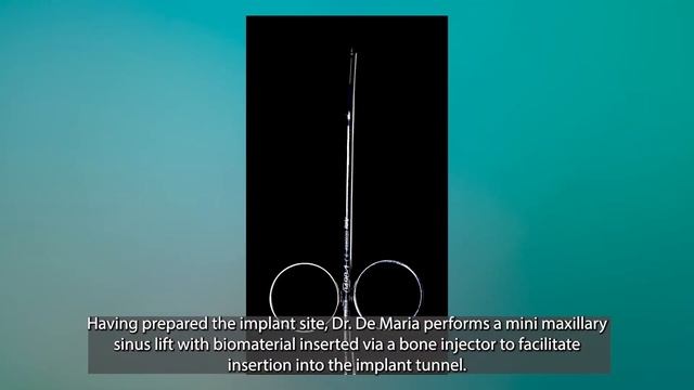 Implant site preparation and mini sinus lift with Black Ruby - Dr. Andrea De Maria смотреть онлайн