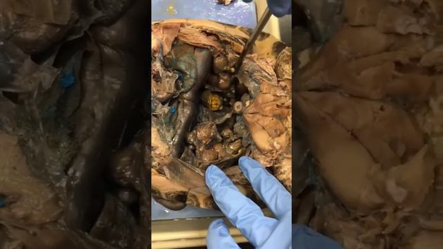 turtle dissection for urogenital and reproductive systems смотреть онлайн