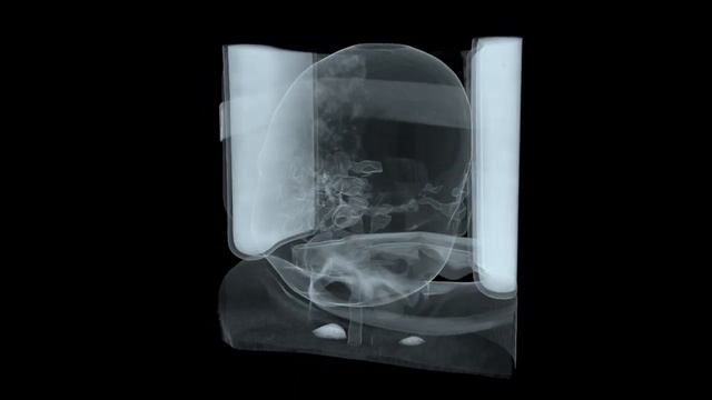 CT Data Visualized in Blender смотреть онлайн