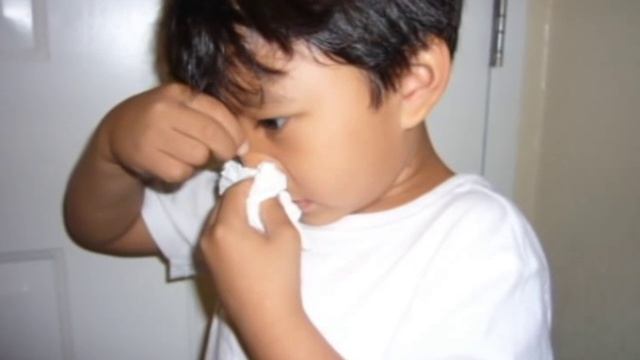 How to treat a Nose Bleed!! смотреть онлайн
