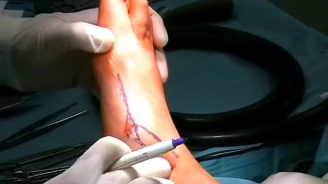 AAOS 2012 - Medialis System 3.5 (ENG)