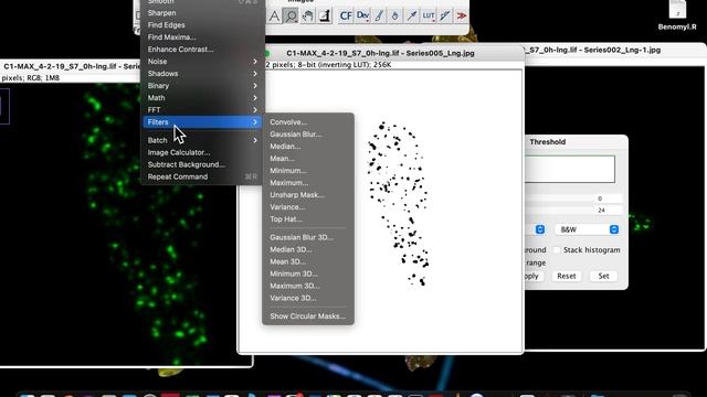 How to count objects in image using ImagJ| counting cells in imageJ| imageJ cell counter смотреть онлайн