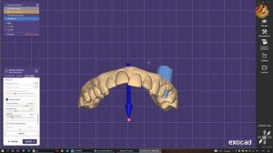 3D печать временной коронки, штампика и модели челюсти. Настройки Exocad и Chitubox. Часть 1