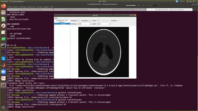 Gadgetron Online Course: Day 2 - Part 1 - MRD (Part 1) Introduction смотреть онлайн