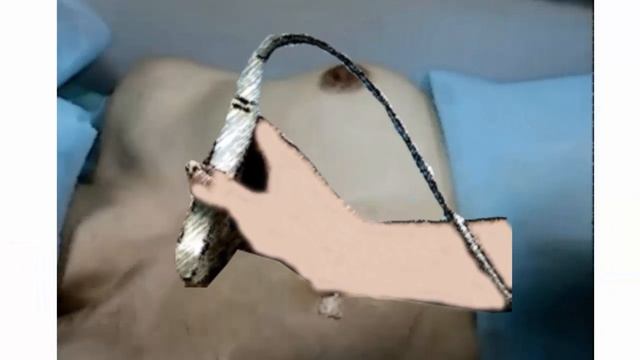 Как делают УЗИ молочной железы смотреть онлайн