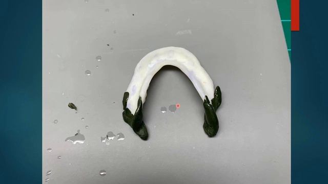 Setting Of Denture Teeth to The Physiologic Needs of The Patient смотреть онлайн