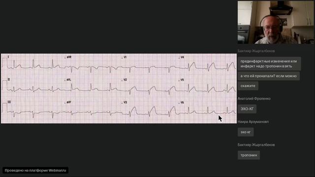 ОКС без ОКС Инфарктоподобные изменения на ЭКГ смотреть онлайн