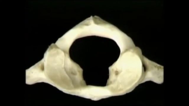 1 и 2 шейные позвонки(Атлант и Аксис) .Разбор с профессором Робертом Акландом. смотреть онлайн