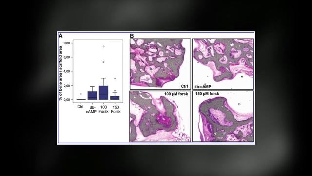 Форсколин: Развитие Костей смотреть онлайн