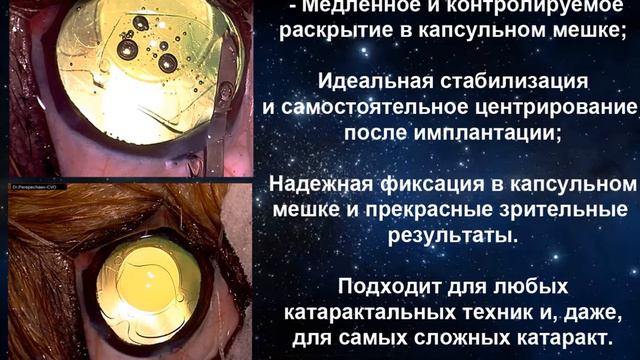 Интраокулярные линзы для животных: AnIOL 40D модели 2019г /IOL for animals: AnIOL 40D models 2019